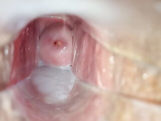 Cum medial pussy close-up speculum